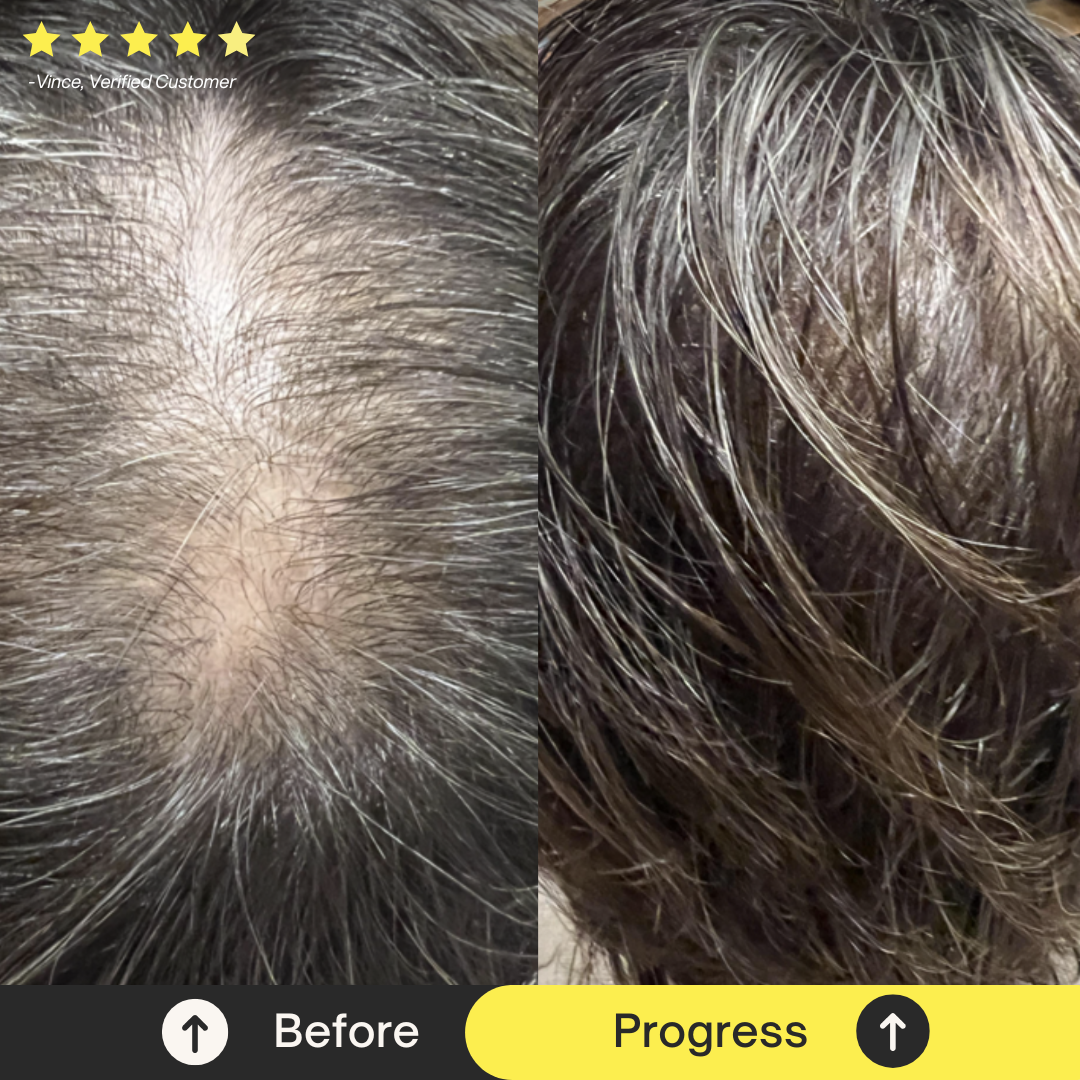 Skin + Hair Regeneration