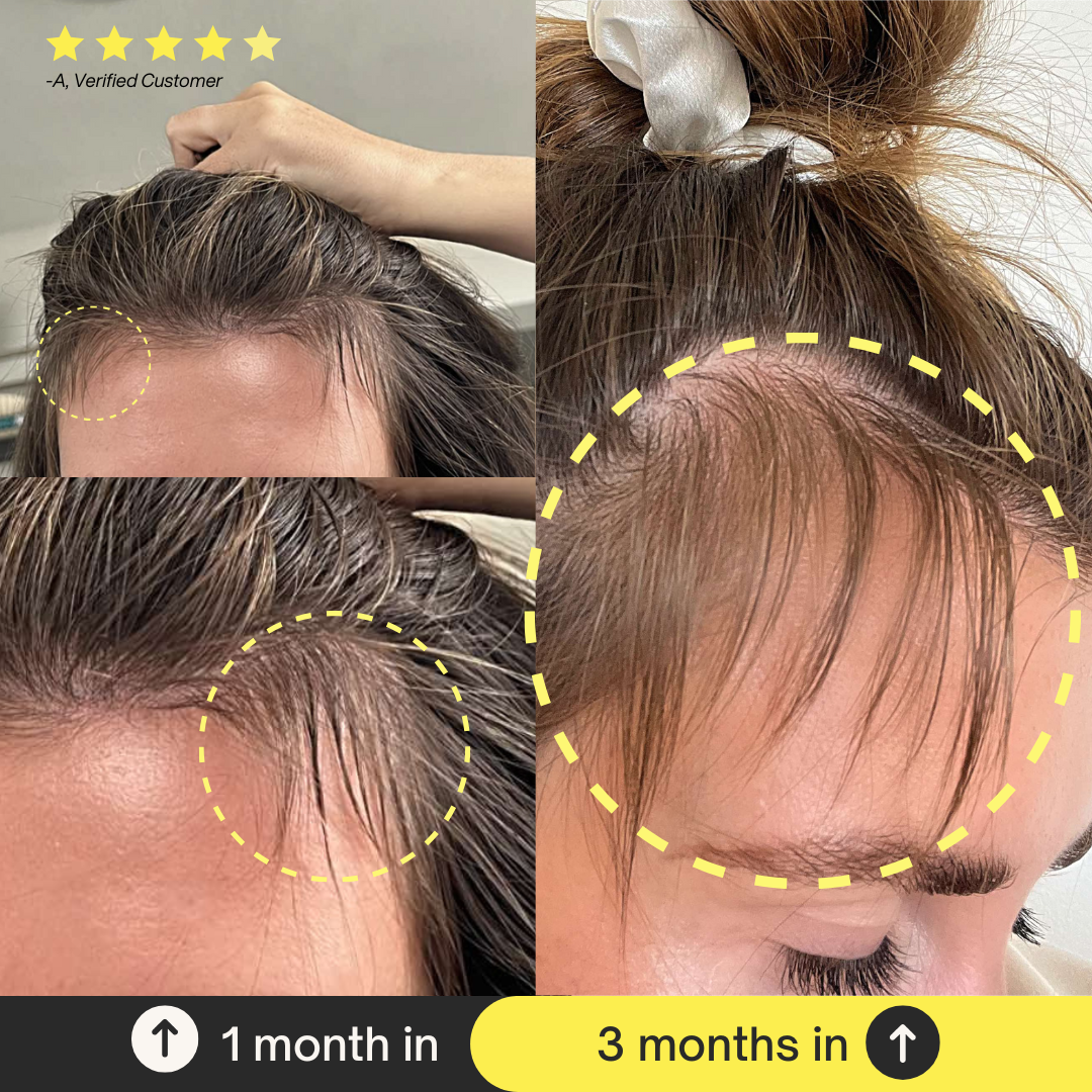 Skin + Hair Regeneration