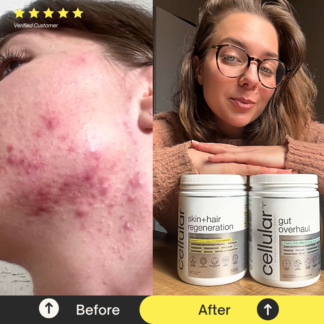 Skin + Hair Regeneration