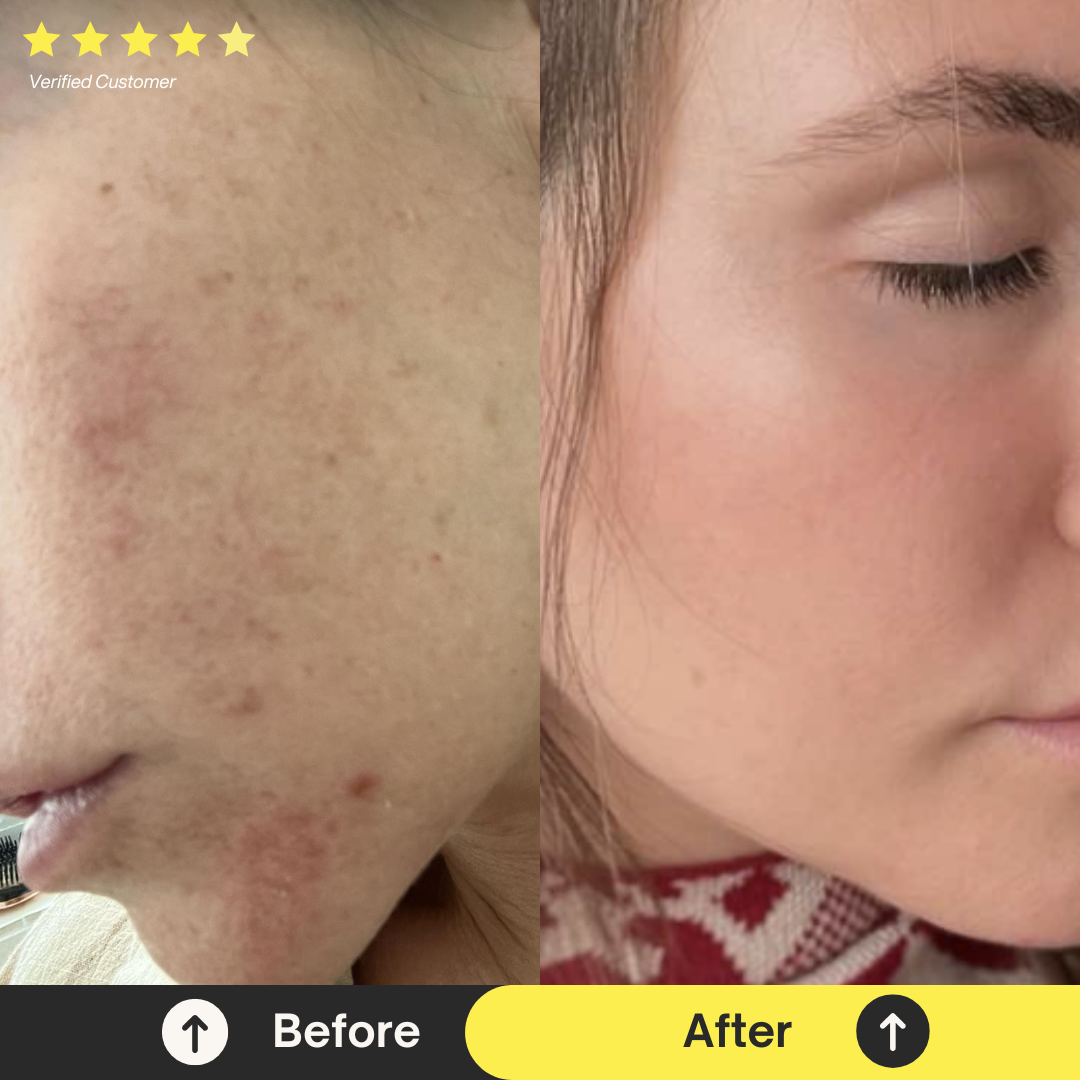 Skin + Hair Regeneration